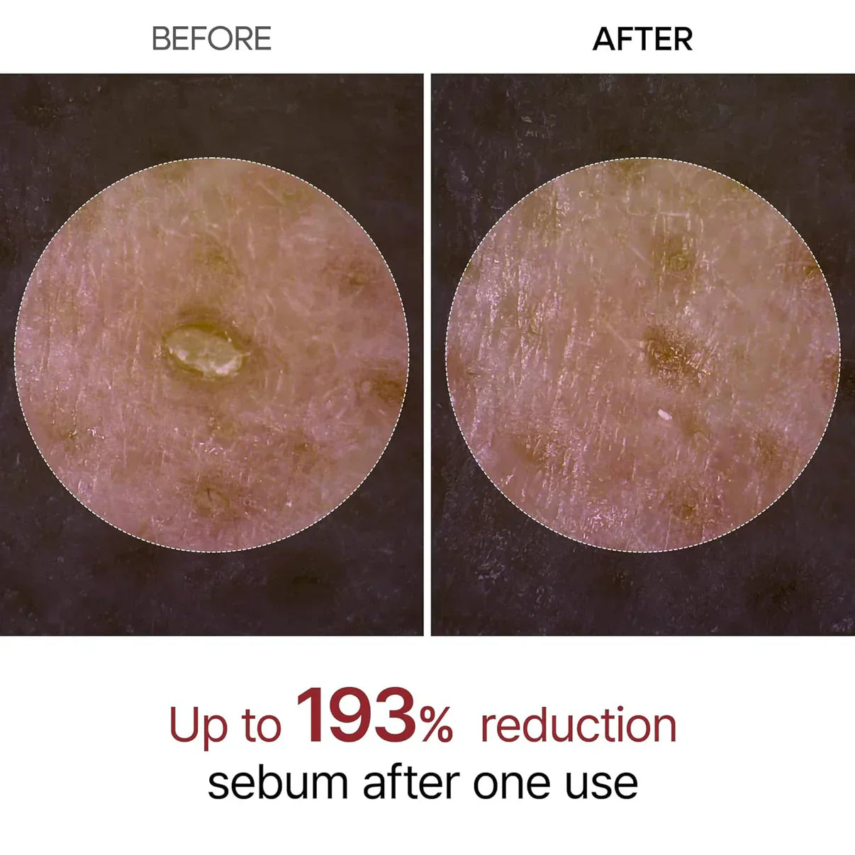 RiceGlow Peeling