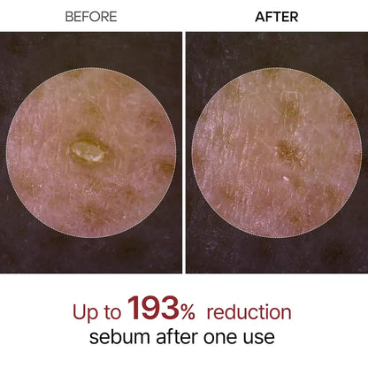 RiceGlow Peeling